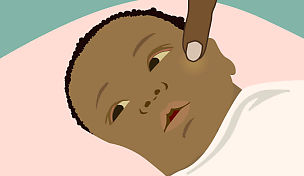 wow-l2-jaundice-id10066-01.jpg